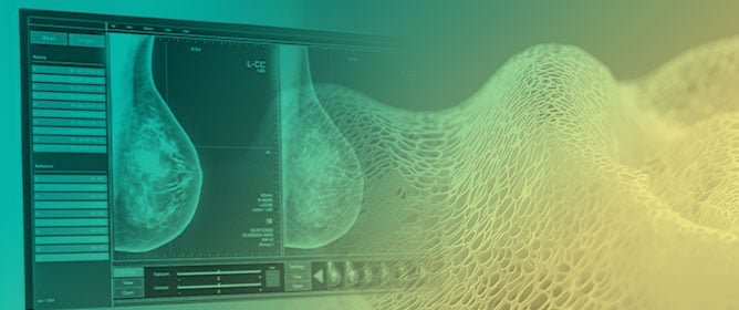 Soft Tissue Scaffolds in Breast Reconstruction: Evolution from Acellular Dermal Matrices to Synthetic Polymers