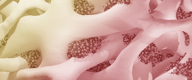A Pragmatic First-Line Screening Assay for <em>PDGFR</em> Rearrangements: A Real-World Clinical Validation