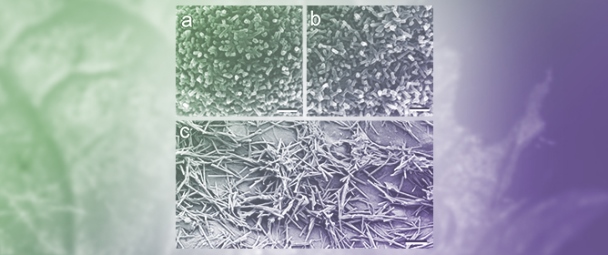 Tubular Wax Projections on Plant Epidermal Surfaces as Anti-Adhesive Coatings for Insects: A Numerical Modeling Approach