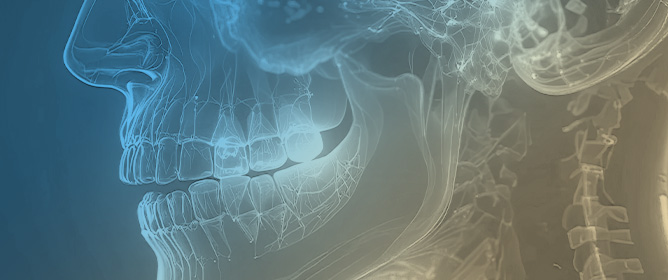 Venous Malformation of the Maxilla: A Systematic Review and a Report of an Unusual Case