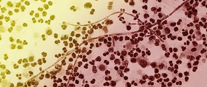 Probiotic and Postbiotic Interactions of <em>Lactobacillus</em> Strains with <em>Candida albicans</em>: Antifungal Effects Through Microbial Competition