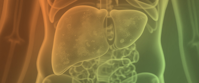 The Role of Primary Care and Noninvasive Testing in the Early Diagnosis of Metabolic-Associated Steatotic Liver Disease (MASLD)