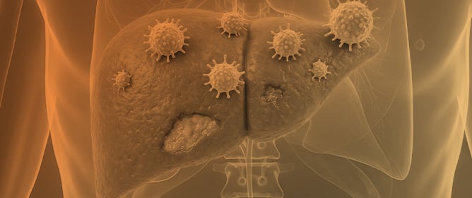 Clinicopathological Features of Autoimmune Hepatitis Stratified by Extrahepatic Autoimmune Diseases