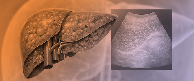 Advances in the Pharmacologic Management of MASLD