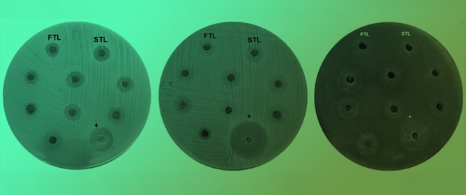 Phytochemical Profile and Biological Activities of <em>Allium longistylum</em> Sprouts