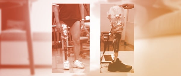 A Proof-of-Concept Framework Integrating ML-Based MRI Segmentation with FEM for Transfemoral Residual Limb Modelling