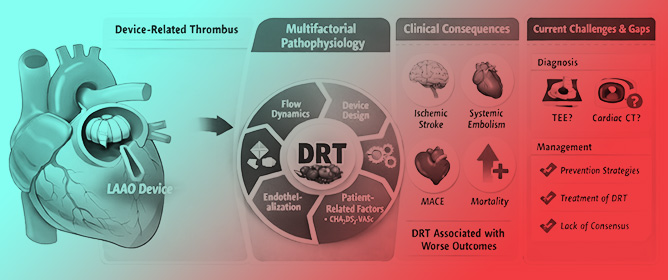 Device-Related Thrombosis After Left Atrial Appendage Occlusion: Updated Management and Contemporary Challenges