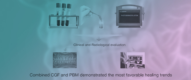 Autologous Platelet Concentrates and Photobiomodulation as Biologically Active Modifiers of Hard and Soft Tissue Healing: A Randomised Controlled Trial