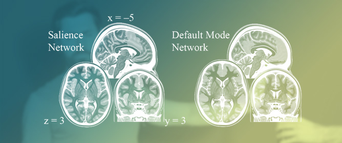 The Effects of Mindfulness on Brain Network Dynamics Following an Acute Stressor in a Population of Drinking Adults