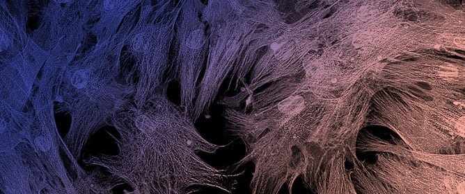 Fibroblast Switching: Origin of Scars and a Regenerative Target