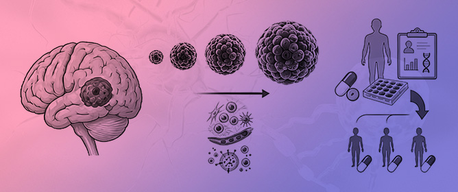 Standardized Workflow for the Generation of Patient-Derived Glioblastoma Spheroids