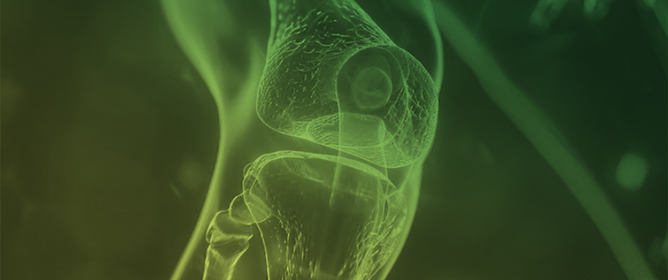 Generalization of Knee Joint Moment Prediction During Drop Vertical Jumps Under Graded Visuo-Proprioceptive Conflict: The Role of Multijoint Kinematics Across Validation Frameworks