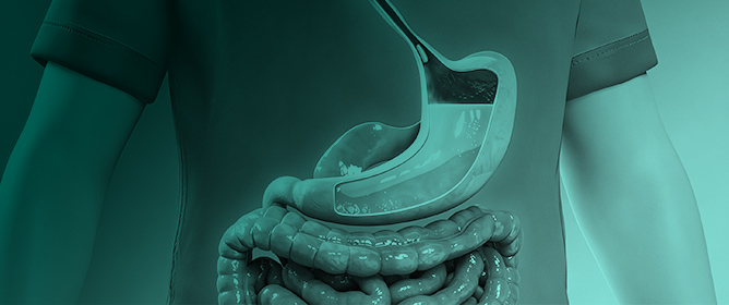 Precision Medicine in Inflammatory Bowel Disease: The Emerging Role of Metabolic Dysfunction