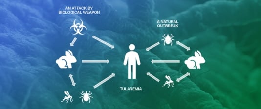 Immunosensors and Immunoassays to Detect Francisella tularensis and Diagnose Tularemia