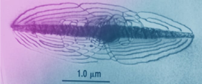 Hysteresis in Precipitation&ndash;Dissolution Cycling of Hydrides in Zirconium Alloys Is an Illusion