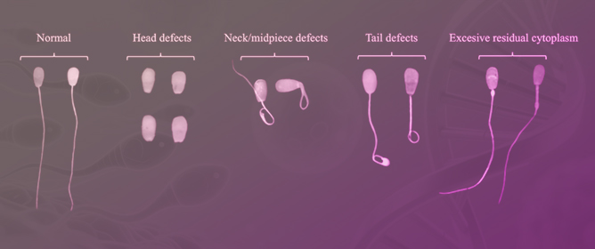 YOLOv7-Based Bovine Sperm Morphology Analysis