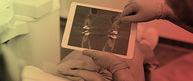 Head Tilt as a Technique to Reduce Contralateral Arch Artifacts in Small Field of View Cone Beam Computed Tomography Imaging
