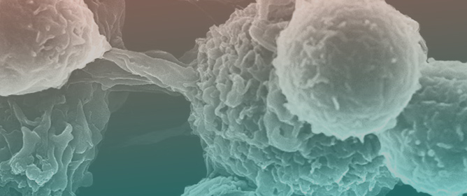 Macrophage Activation Syndrome Following Atezolizumab in Advanced Non-Small-Cell Lung Cancer: A Case Report