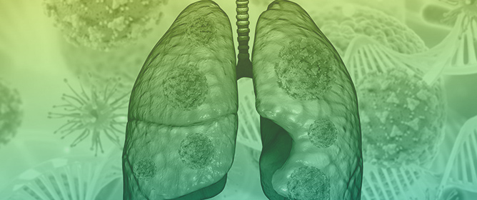 Established and Emerging Less Invasive Biomarkers and Technologies for Lung Cancer Screening: Puerto Rican Context