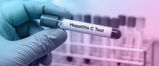 Hepatitis C Virus: An Overview of Its Chronic Impact on Liver Function, Metabolic Dysregulation, Inflammatory&ndash;Oxidative Pathogenesis and Epigenetic Memory