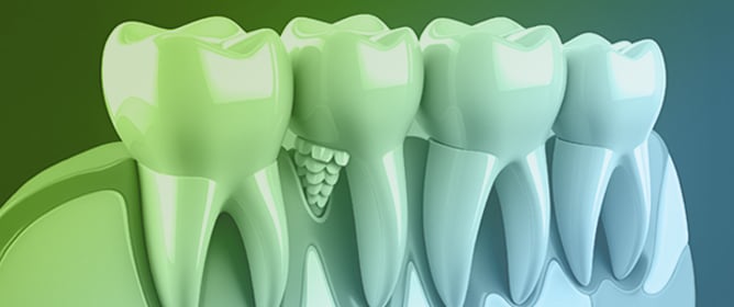 Osteoimmunology of Natural and Synthetic Biomaterials Used in Dentistry for Bone Remodeling