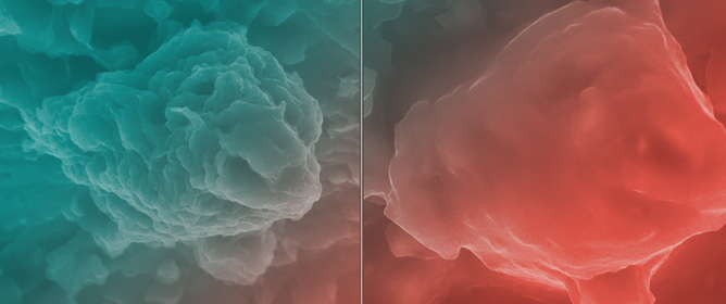 Coupled ESEM and XRD Analysis of Montmorillonite Hydration