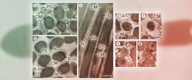 Ultrastructure of the Mature Spermatozoon of <em>Gerbillitaenia psammomi</em> (Cestoda: Catenotaeniidae) and Its Phylogenetic Implications