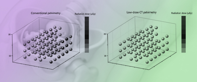 Evaluation of Radiation Dose and Image Quality in the Transition from Conventional Pelvimetry to Low-Dose Helical CT Pelvimetry