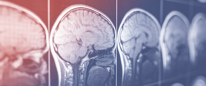 Equity, Function, and Data: A Review of Social and Functional Representation in AI Datasets for Traumatic Brain Injury
