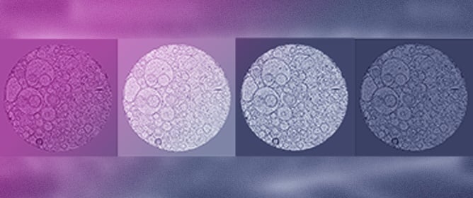 Cryogenic Electron Microscopy of Extracellular Vesicles from Temozolomide-Treated Glioblastoma Cells Reveals Great Morphological Heterogeneity