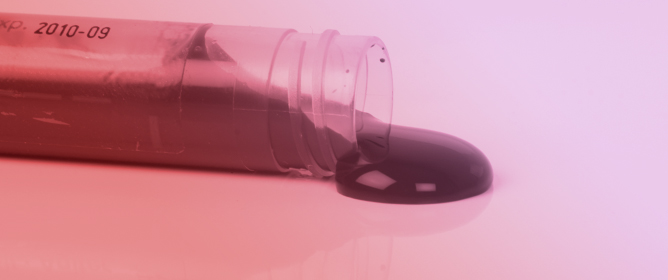 Age and Gender Differences in Blood Viscosity: Clinical Laboratory Insights for Diabetes Management