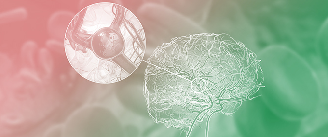 Impact of ABO Blood Group on Vascular Complications and Outcome After Aneurysmal Subarachnoid Hemorrhage