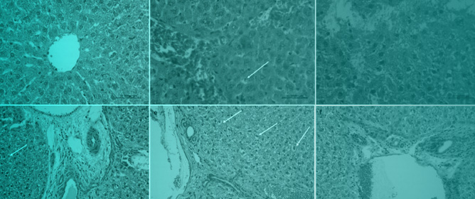 Benchmark Approach to Unravel Fluoride Toxicity: Liver and Kidney Disruptions in Subacutely Exposed Rats