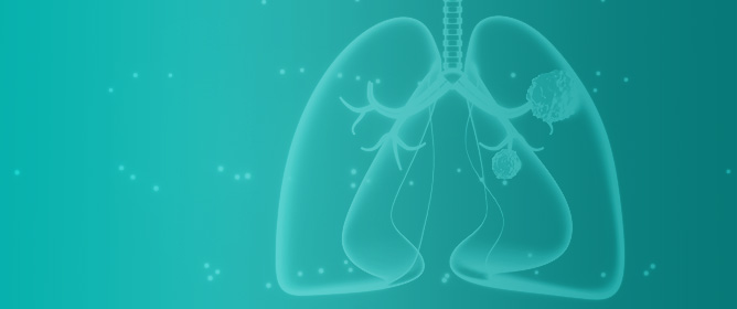 The Association of Microplastics in Peripheral Blood and Pulmonary Disease: A Pilot Study