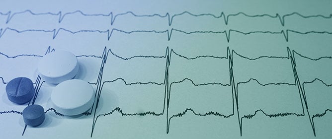 The History of the Precordial Early Repolarization and Sudden Death Syndrome, Lately Named Brugada Syndrome