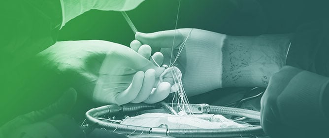 Current Trends and Future Challenges in Transcatheter Aortic Valve Implantation (TAVI): A Narrative Review