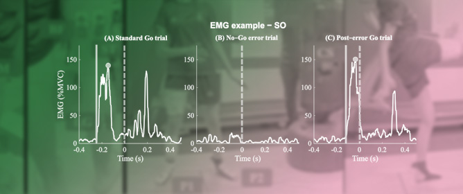 Wearable Wireless EMG Sensors for Monitoring Post-Error Neuromuscular Responses During a Sport-Specific Inhibitory Control Task