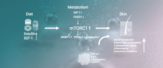Lipid Metabolism, Body Composition, and Diet in Acne Vulgaris: A Narrative Review