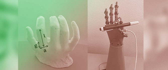 Development of a Modular Bionic Hand with Intuitive Control and Thumb Opposition