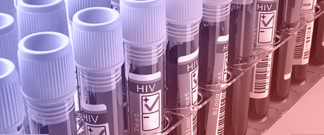 Divergent TaqMan RT-qPCR for Detection of HIV-1 Circular RNAs