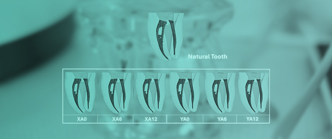 Does Aging Affect PolyJet 3D-Printed Teeth for Endodontics? A Micro-CT Evaluation