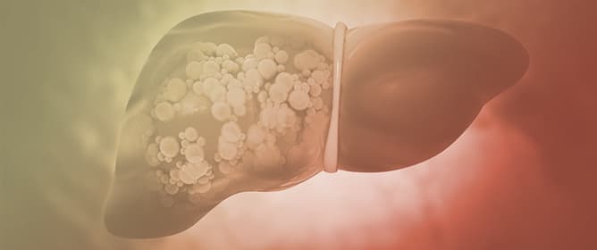 Development and Internal Validation of a Novel Pediatric-Adapted Liver (PAL) Score for Predicting Advanced Fibrosis: Comparison with Transient Elastography