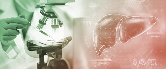 From FIB-4 to the Artificial Intelligence Era: The Evolution of Non-Invasive Tools (NITs) for Tailored Risk Stratification in Metabolic Dysfunction-Associated Steatotic Liver Disease (MASLD)