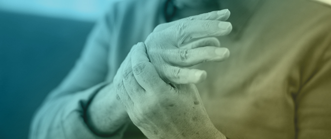 Sex-Specific Cognitive Divergence in Parkinson&rsquo;s Disease