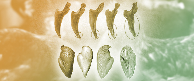 Sternal Region in Poultry: Linking Skeletal and Muscular Disorders Associated with Keel Bone Damage in Laying Hens and Breast Muscle Myopathies in Broilers