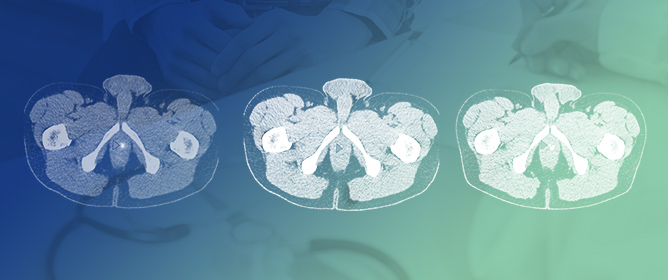 Head-to-Head Comparison of [68Ga]Ga-PSMA-11 PET Interpreted with Non-Contrast CT Versus Excretory-Phase CT Urography in Biochemical Recurrence of Prostate Cancer