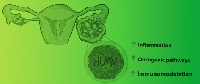 HCMV as an Oncomodulatory Virus in Ovarian Cancer Progression