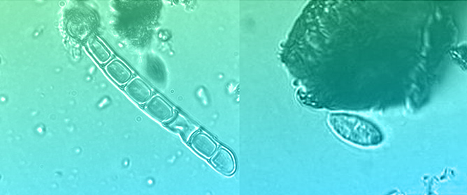 Innovating Slow Sand Filtration: Exploring the Regeneration of a Traditional Technology for the 21st Century