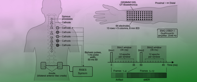 Objective Biomarker Development for Parameter Optimization in Neuromodulation Using High-Density EMG Temporal and Spatial Features