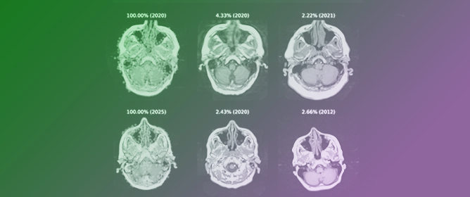 Automatic Personal Identification Using a Single MRI Slice